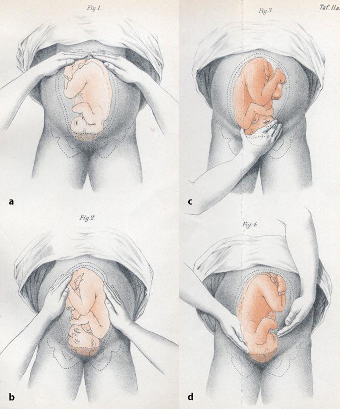 OB-GYN (Obstetrics and Gynaecology - Wikipedia