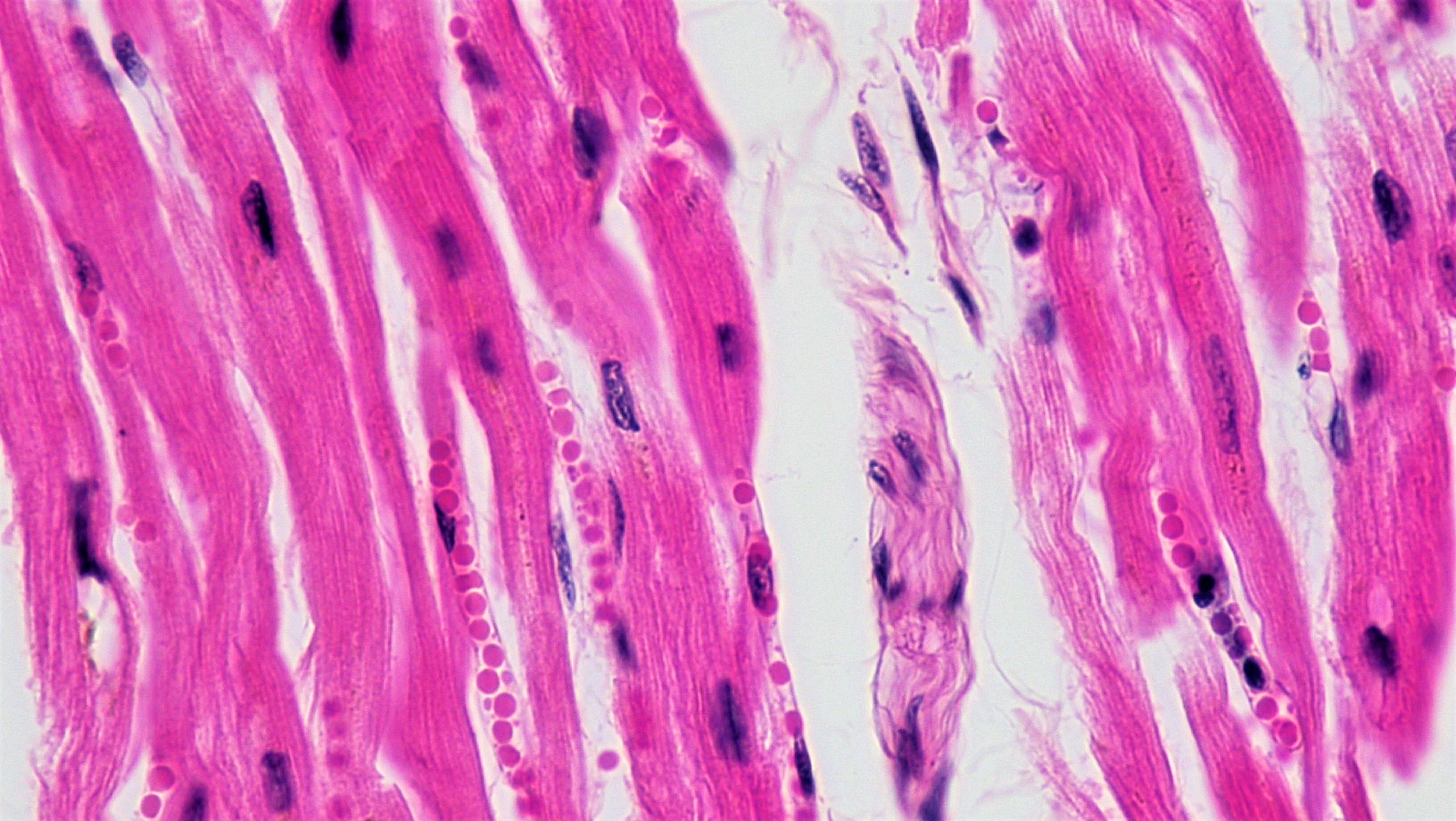 Клетки гладкой ткани. Striated Cardiac muscle Tissue. Кардиомиоциты гистология. Поперечно полосатая мышечная ткань гистология. Гладкая мышечная ткань muscular Tissue.