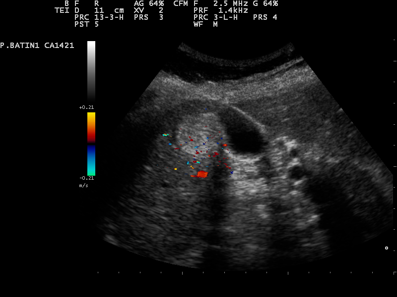 File:Ultrasound Scan ND 0128145808 1502570.png