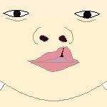 Cleft lip left 1 front.png