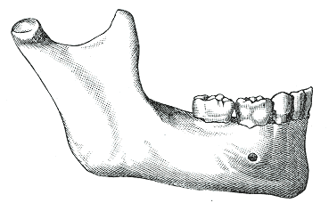 Mandible