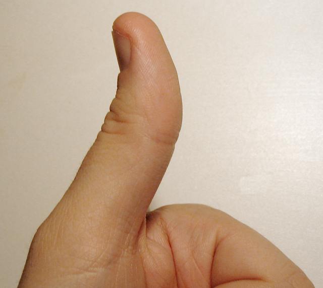 thumb là gì