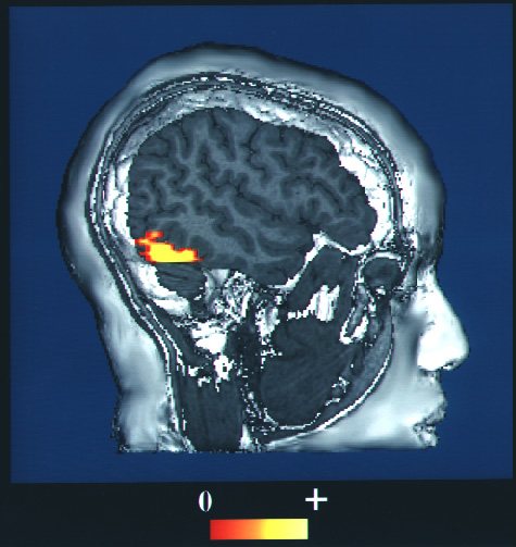  Fusiform face area face recognition 