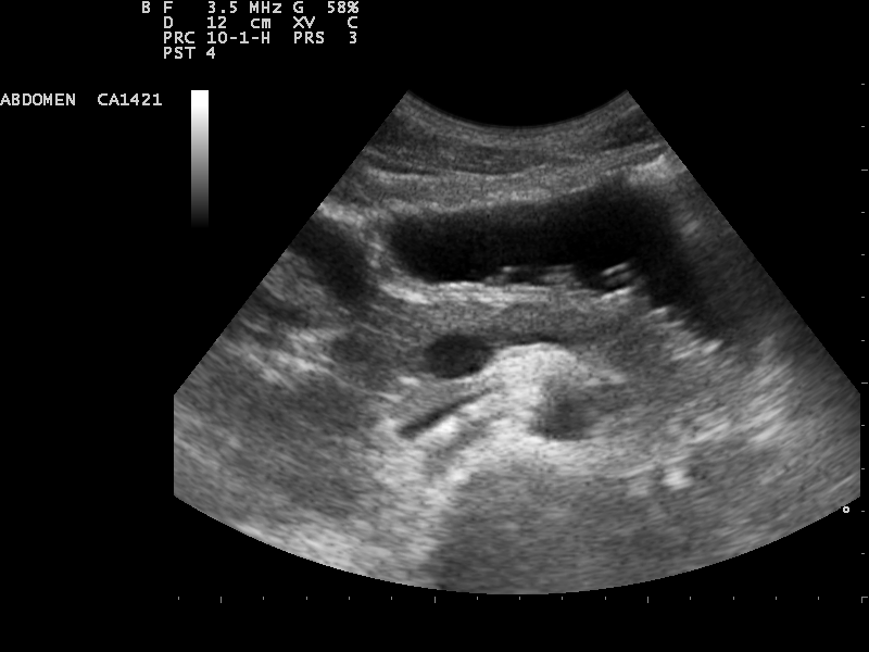 File:Ultrasound Scan ND 1230082336 0825470.png