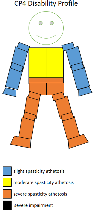 The spasticity athetosis level and location of a CP4 sportsperson. CP4 disability profile.png