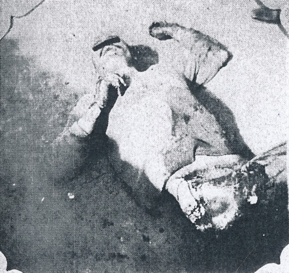 File Massacred Corpse Of A Japanese Victim Of The Tungchow Massacre Jpg Wikimedia Commons