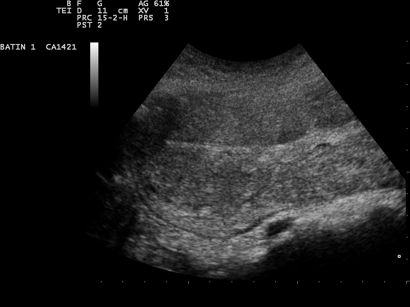 File:Ultrasound Scan ND 1230094821 095140.png