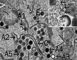 viralen Assemblierungs­stelle mit FV3-Virionen in ver­schiedenen Stadien der Assemblierung. Inset: Membranen (↗), evtl. aus dem ER.