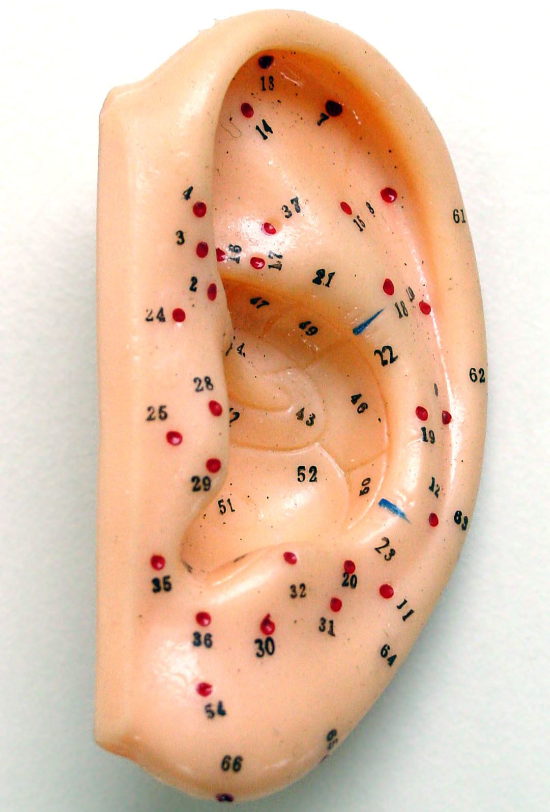 Acupuncture for natural healing — Pulse Podiatry%