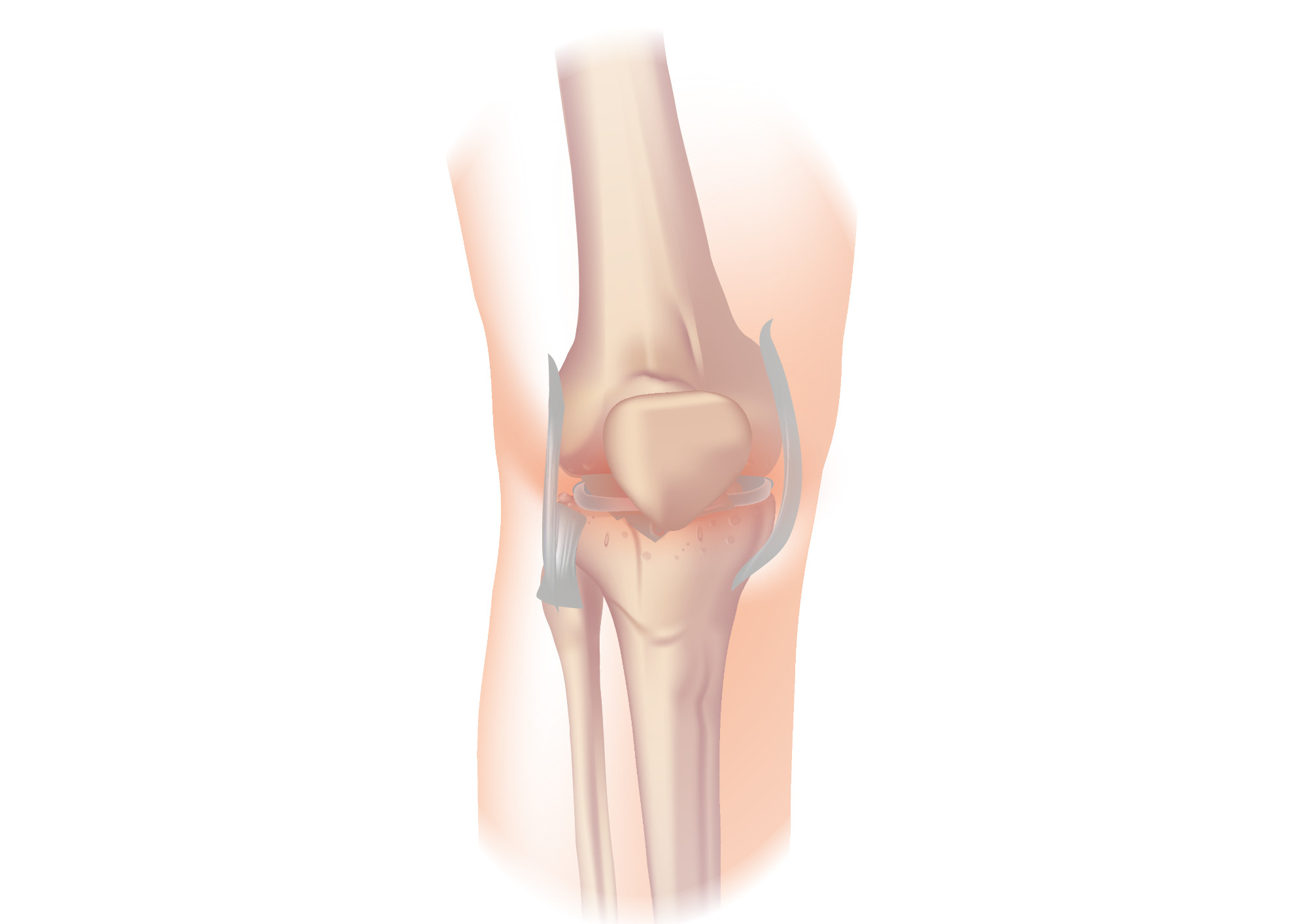 Knee joint. Суставы. Коленный сустав без фона. Боль в колене.