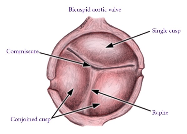 Aortic valve - Wikipedia