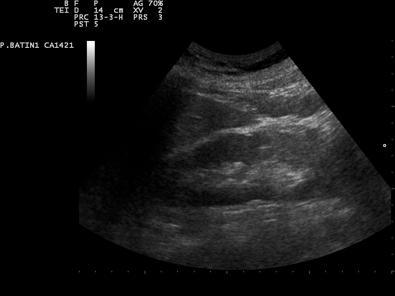 File:Ultrasound Scan ND 0118102928 1035540.png