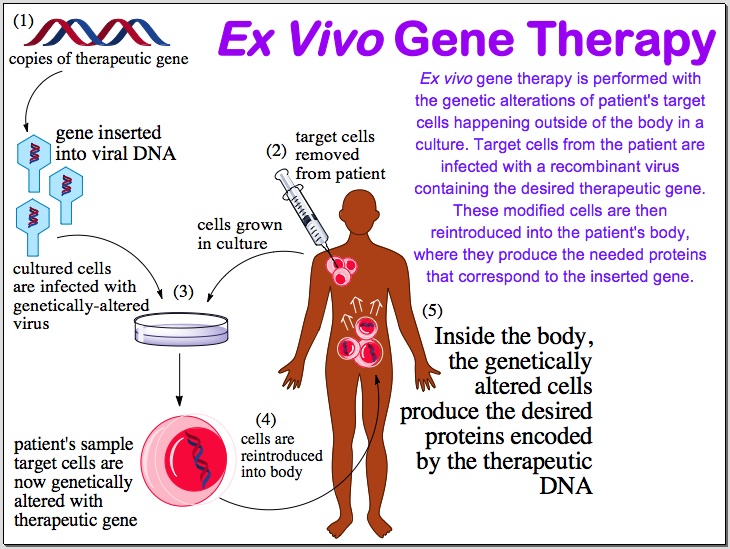 File:ExVivoGeneTherapy.jpg