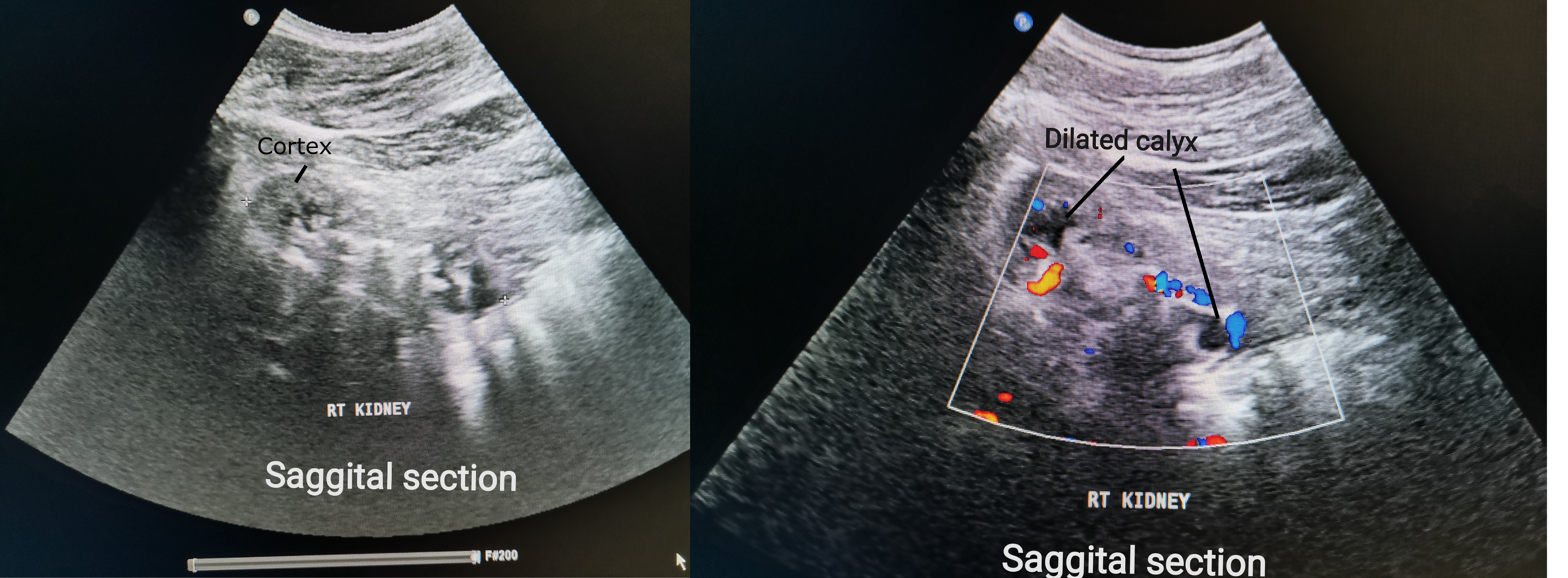 Unveiling the Wonders of Ultrasound Imaging: A Detailed Exploration