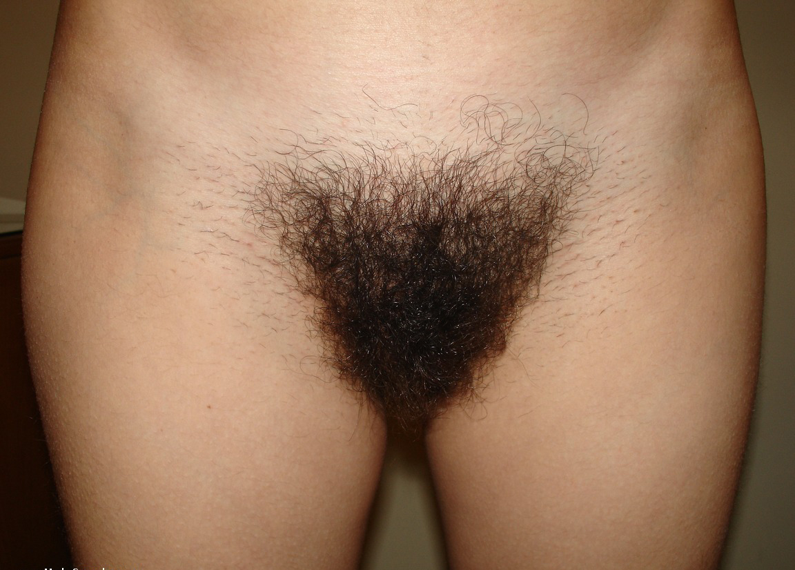 File:Hairy pubis.jpg - Wikimedia Commons