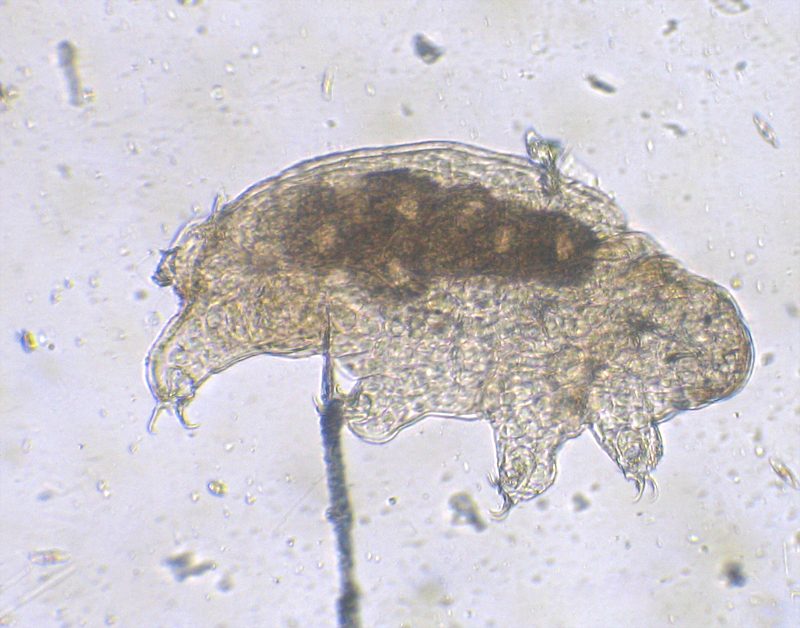 Tardigrada -b.jpg