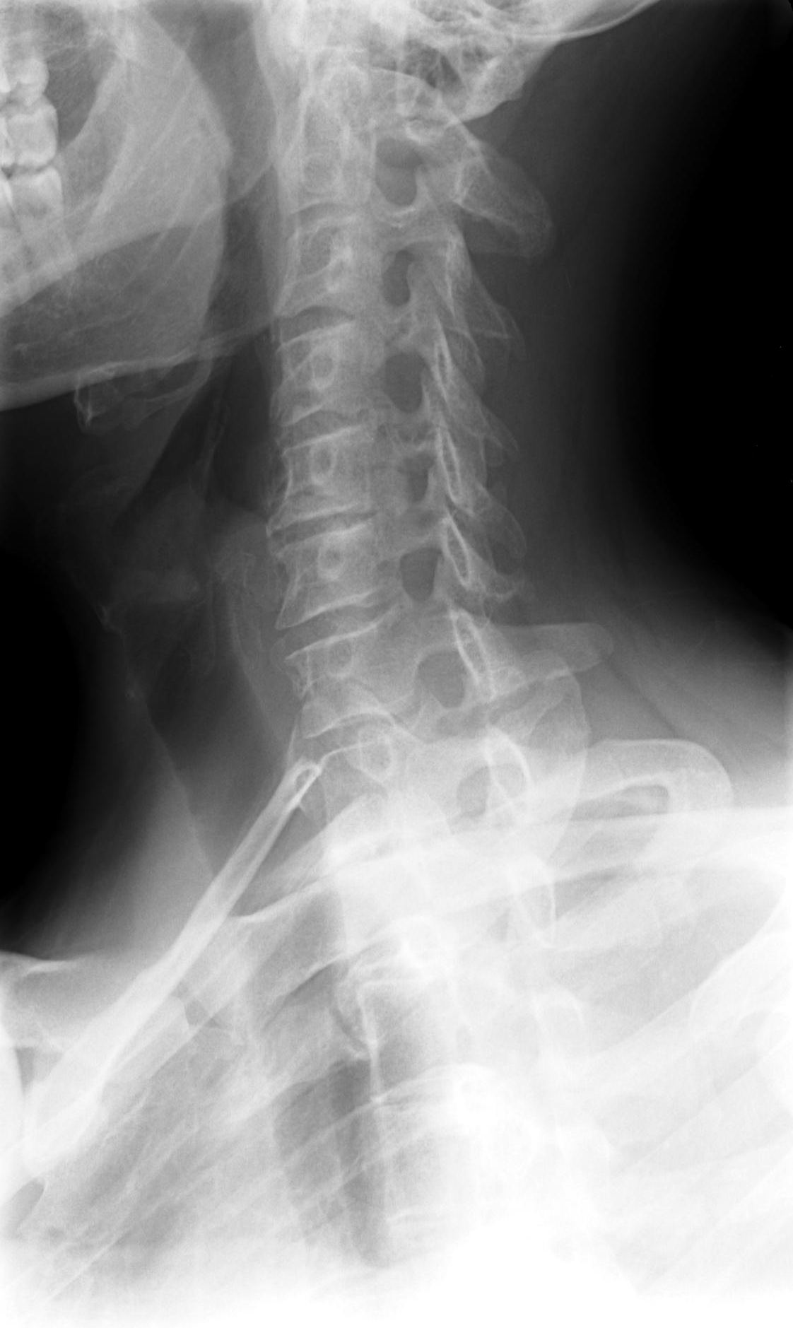 neck anatomy lateral radiography