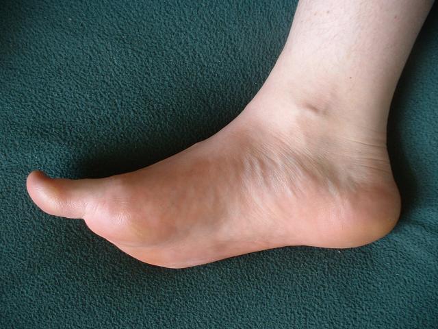 File:Foot-inside.jpg