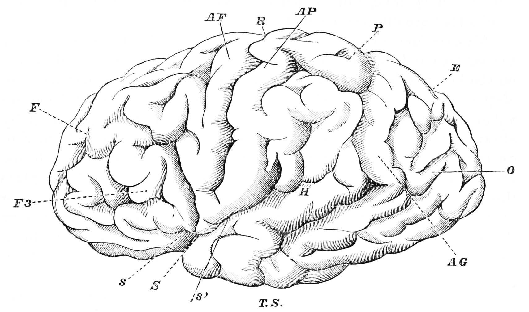 brain fissures