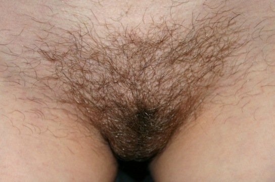 File:Female pubic hair (2).jpg
