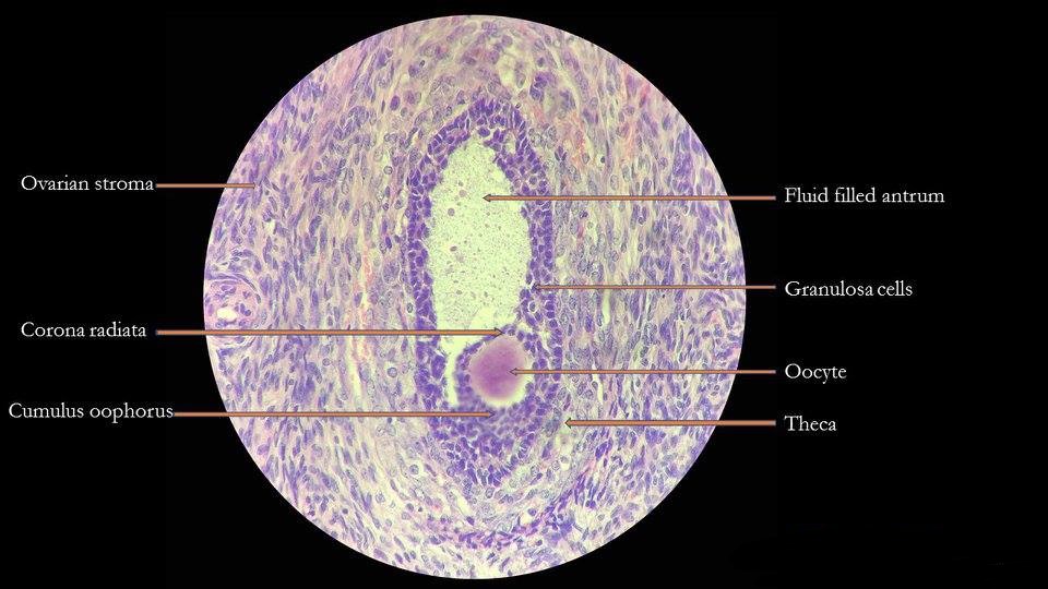 graafian follicle ultrasound