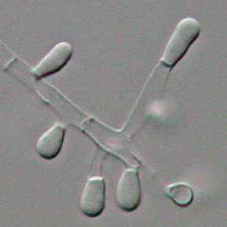 Tinea Capitis Caused by Trichophyton Tonsurans