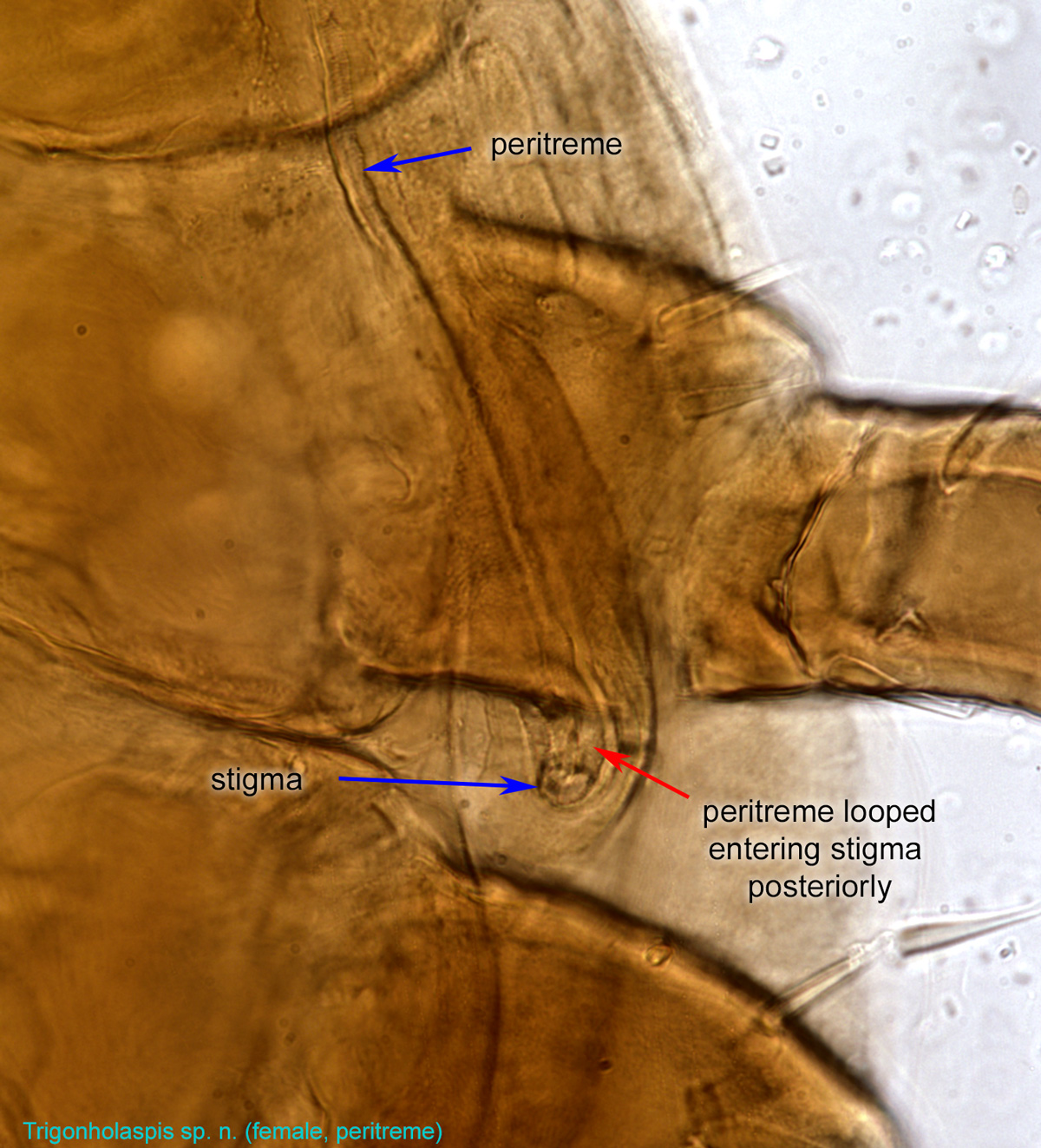 lumbar triangle cadaver