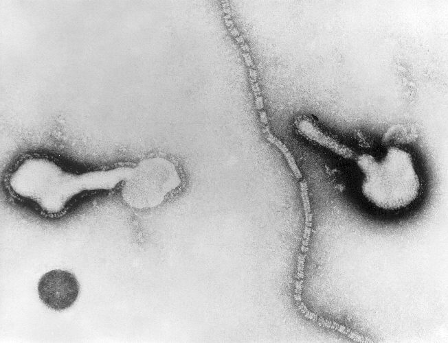 File:Parainfluenza virus TEM PHIL 271 lores.jpg