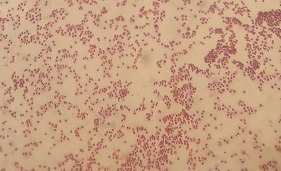 File:Staphylococcus aureus Gram stain.jpg - Wikimedia Commons