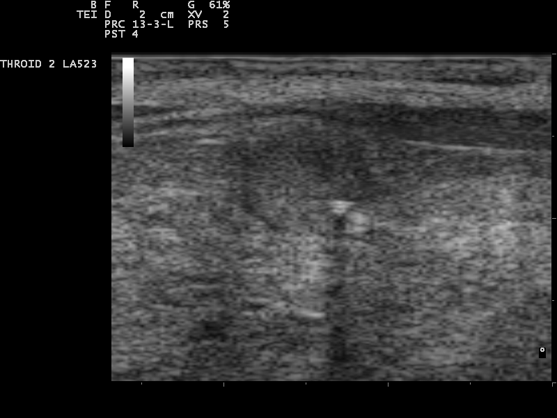 File:Ultrasound Scan ND 0124152900 1535520.png