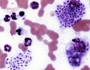 Sporotrichosis primary systemic mycosis that results in a systemic fungal infection, has material basis in Sporothrix schenckii in animals and humans and results in formation of red papule at the site of inoculation