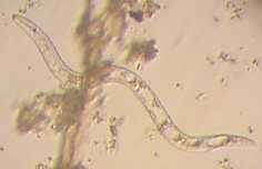 <span class="mw-page-title-main">Dorylaimida</span> Order of roundworms