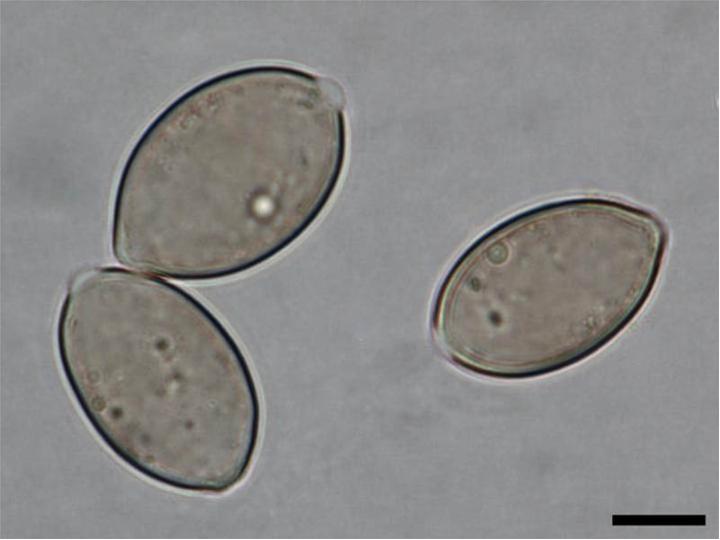 File:Pseudoperonospora cubensis sporangia.jpg