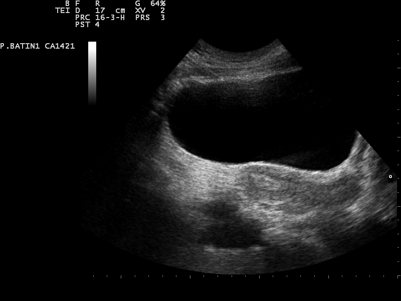 File:Ultrasound Scan ND 0126135155 1356050.png