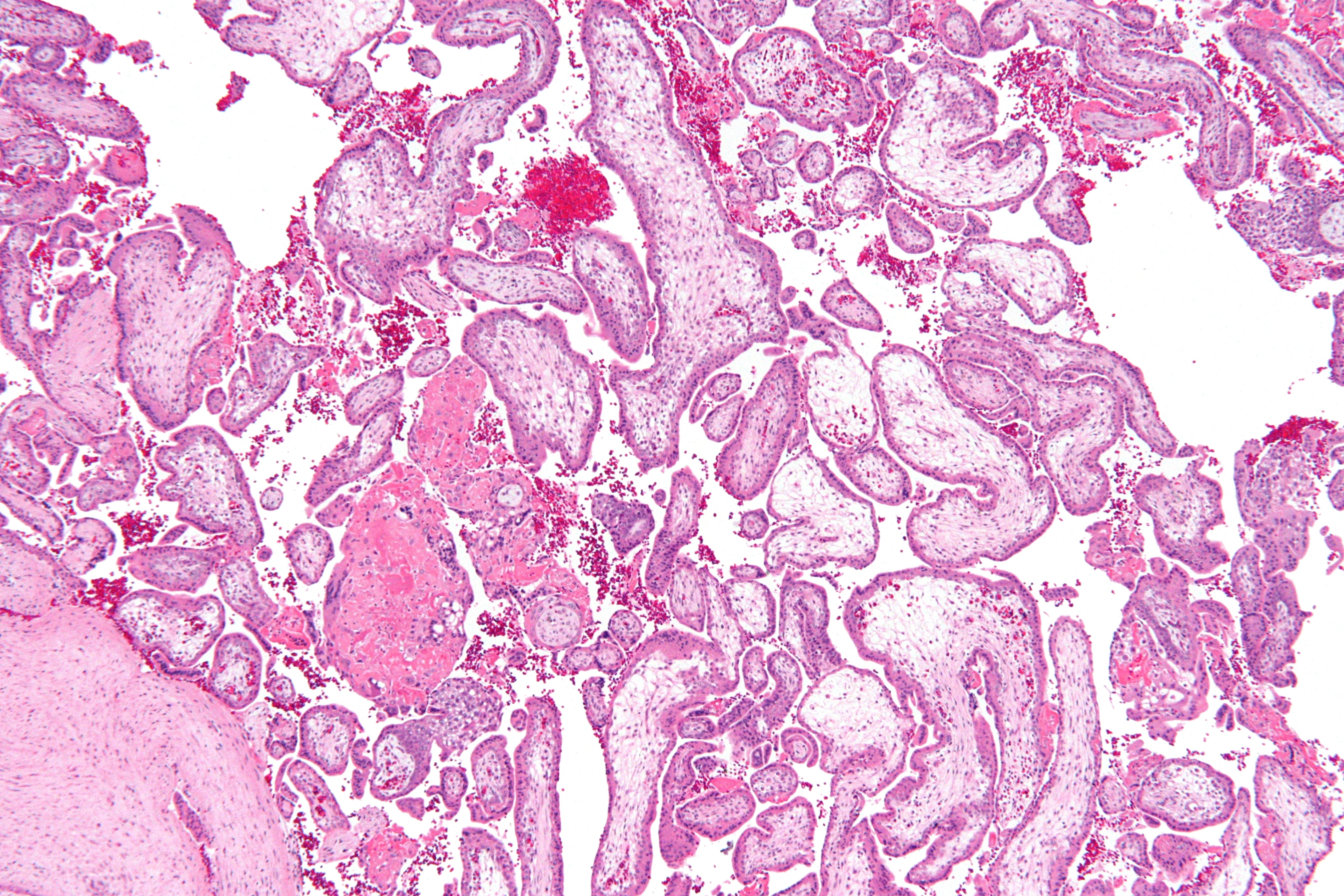 chorionic villi histology