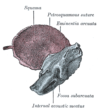 internal acoustic meatus temporal bone