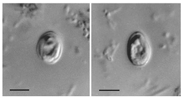 Cryptosporidium - Wikipedia