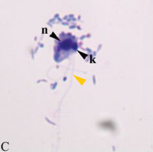 File:Giemsa-stain-of-Colpodella-sp-and-B-caudatus-The-diprotist-culture-was-centrifuged-and-C.jpg
