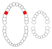 <span class="mw-page-title-main">Maxillary second premolar</span> Upper teeth on the sides of the mouth