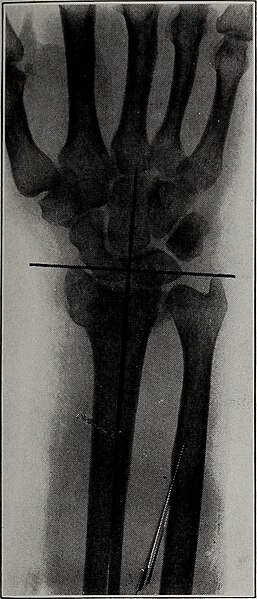 File:American quarterly of roentgenology (1912) (14756940182).jpg