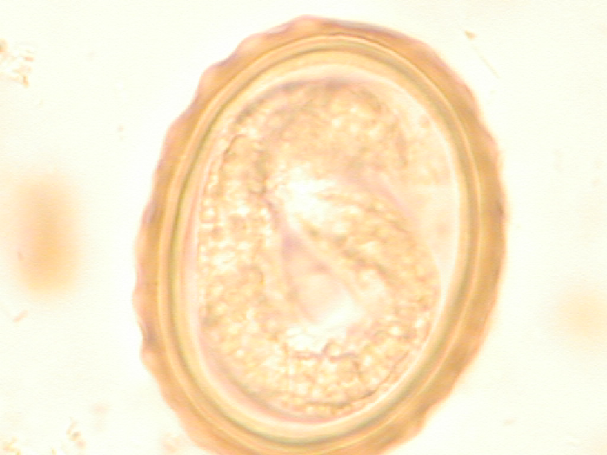 Аскариды откладывают яйца. Ascaris lumbricoides яйца микроскоп. Яйца аскариды под микроскопом.