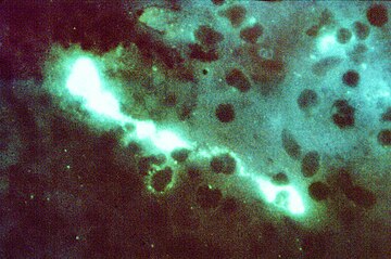 Direct FA stained mouse brain impression smear reveals the presence of the bacterium Chlamydia psittaci. 400X. Chlamydophila psittaci FA stain.jpg