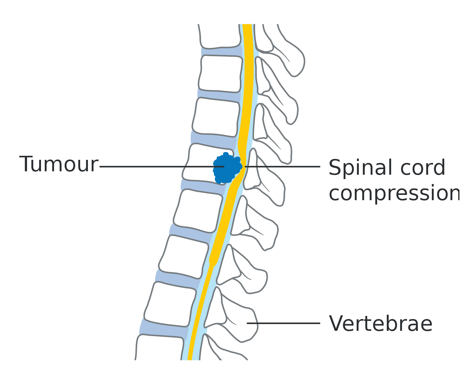 Spinal Cord. Spinal Cord Compression.