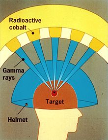 NRC graphic of the Leksell Gamma Knife Gamma Knife Graphic.jpg