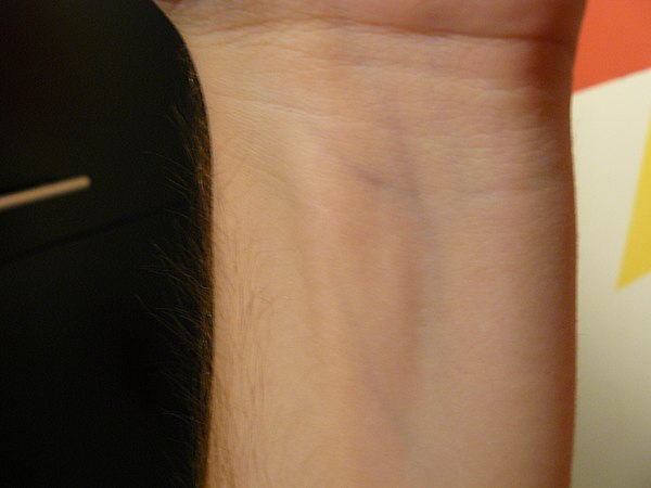 Image of a wrist with peripheral veins visible Image of a wrist with blue veins visible.JPG
