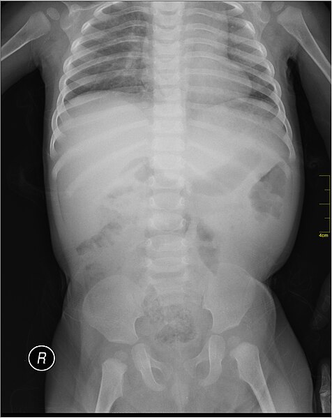 File:Medical X-Ray imaging SZV07 nevit.jpg