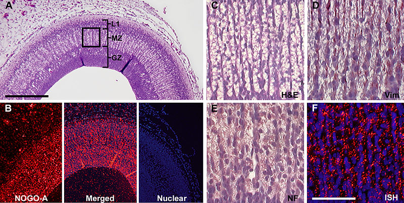 File:NOGO-A expression during cell migration.jpg