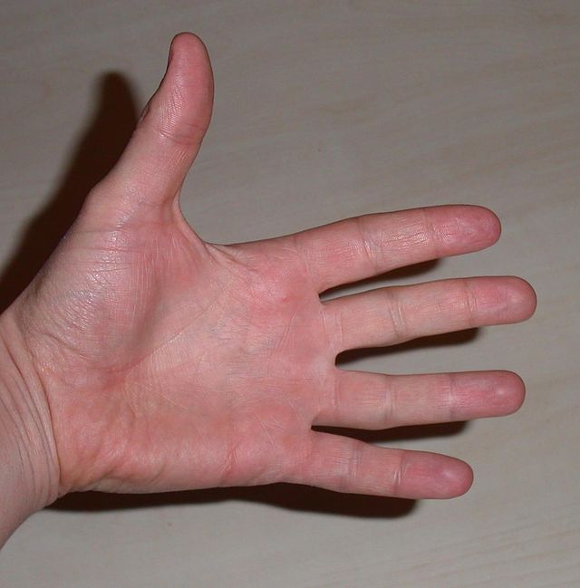 Ring finger - Wikipedia