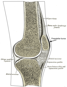 Maladie de Hoffa — Wikipédia