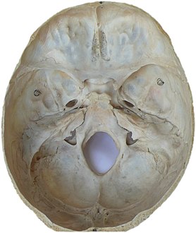 The interior of the skull has sharp ridges by which a moving brain can be injured.